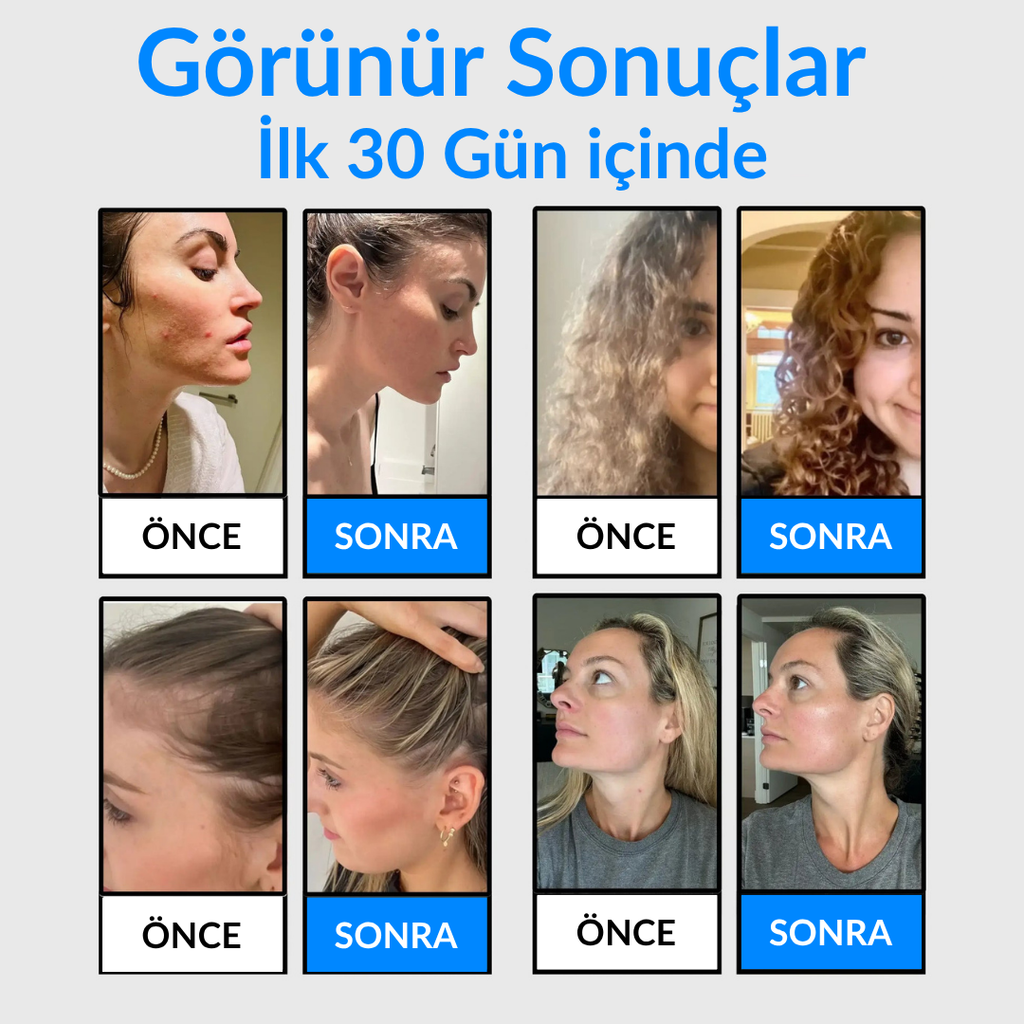 AquaRole Yeni Nesil Filtreli Masajlı Duş Başlığı