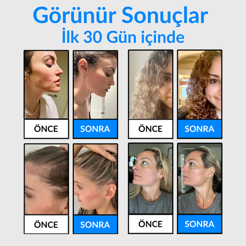AquaRole Yeni Nesil Filtreli Masajlı Duş Başlığı